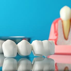 A smiling middle-aged woman using dental bridges