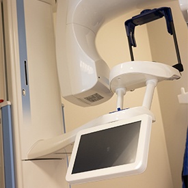 CBCT Scanner