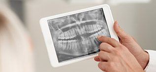 Panoramic digital dental x-rays