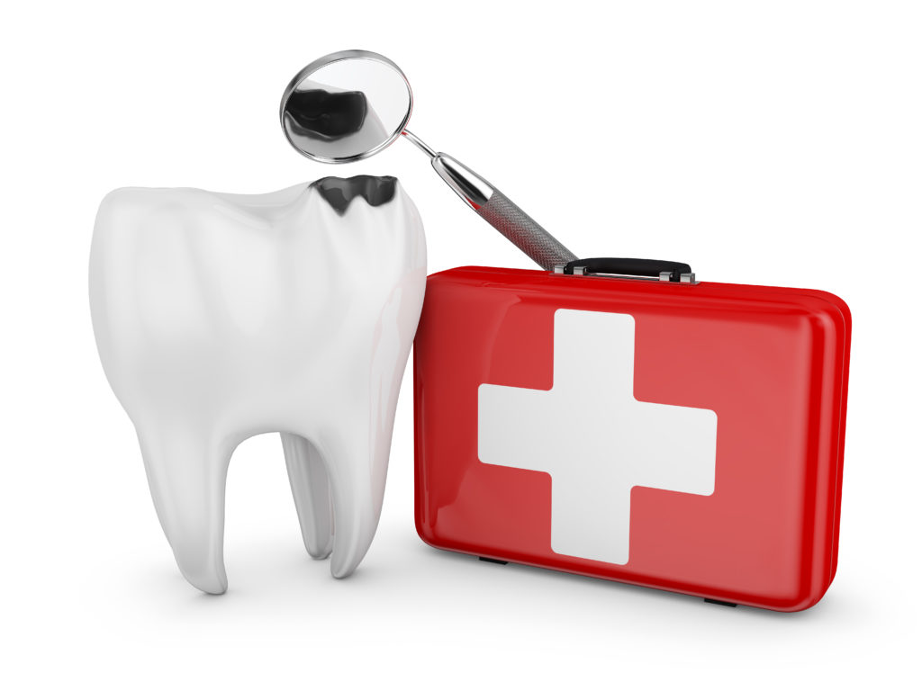 A diagram of a damaged tooth.