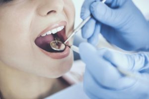 La Plata dentist placing dental sealants