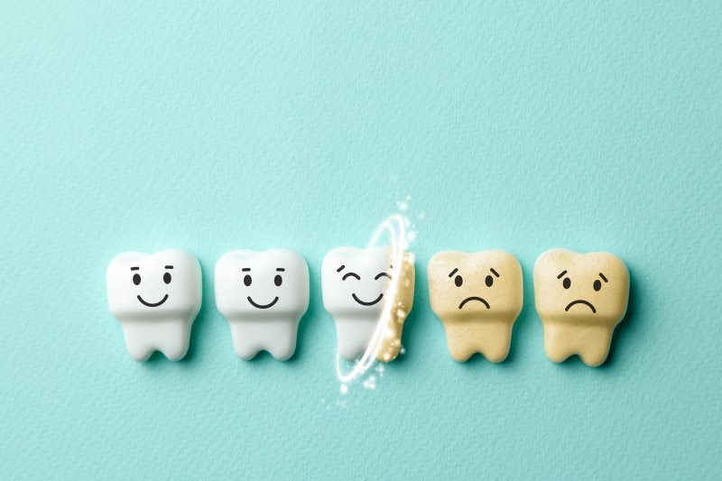 Illustration of teeth whitening