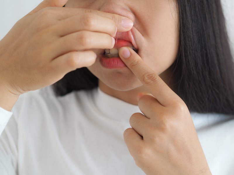 young woman pointing to gum irritation