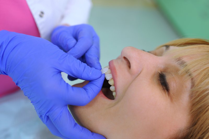 A patient replacing their dental veneers