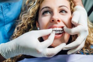 Woman getting Invisalign at dentist's office.